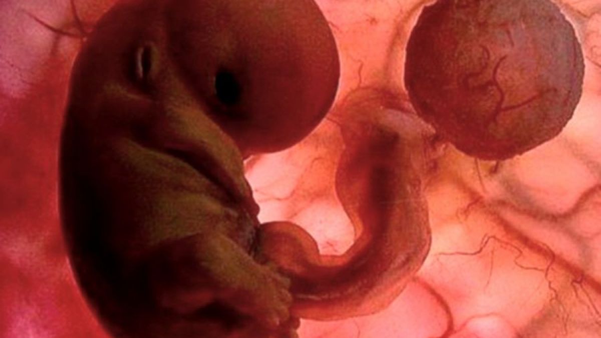 C�mo verdaderamente luce un feto de 3 meses.